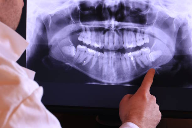 Best Cracked Tooth Emergency Dentist  in Ledgewood, NJ